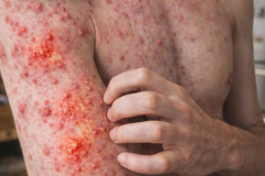 Hasaasiya-Jildi-Aama