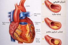 ahass-biBad-al-aam-and-asbaab